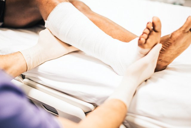 Arzt hilft einem Patienten mit einem gebrochenen Bein – Symbolbild für Physiotherapie - Tipps zur Abrechnung mit einem Unfallversicherungsträger