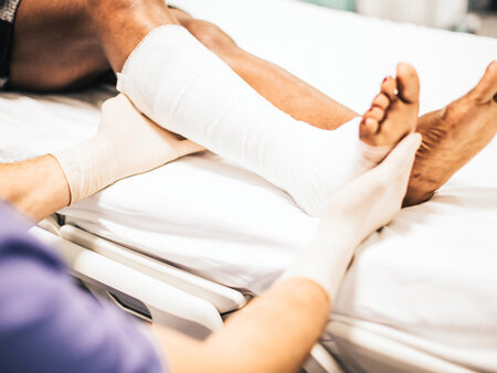Arzt hilft einem Patienten mit einem gebrochenen Bein – Symbolbild für Physiotherapie - Tipps zur Abrechnung mit einem Unfallversicherungsträger
